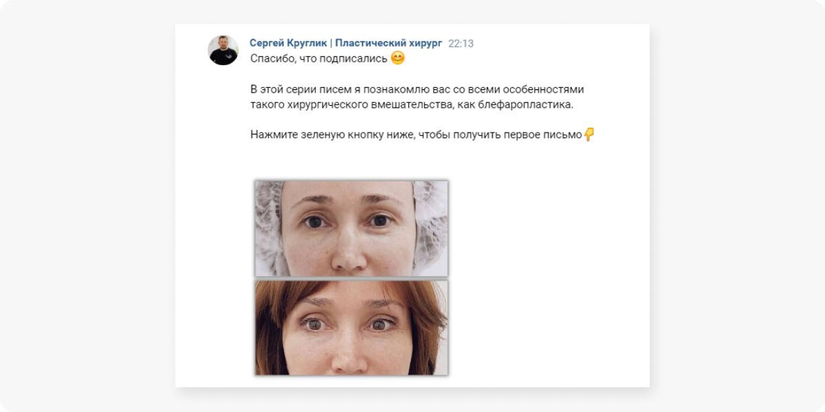 Пример автоматической рассылки ВКонтакте с приветствием подписчика